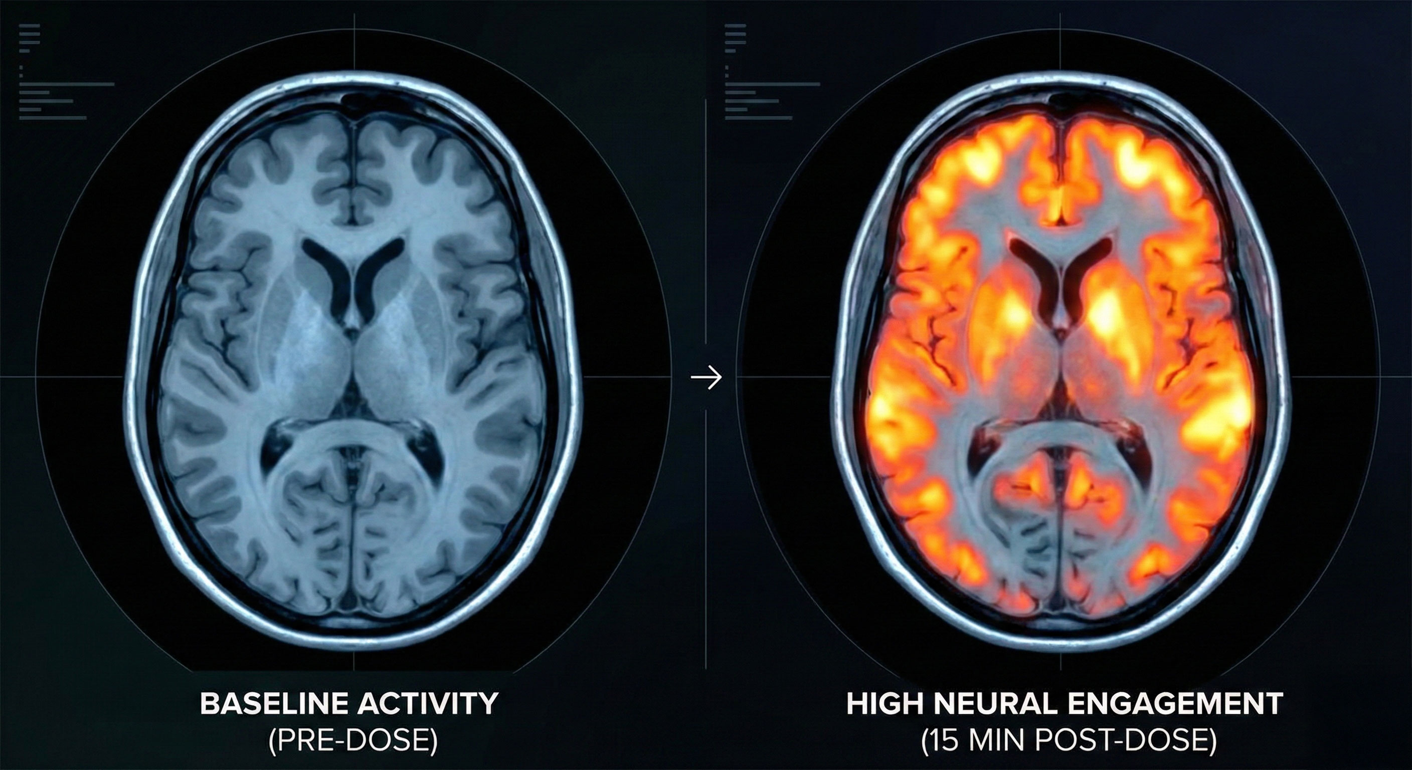 fMRI Brain Scan Comparison
